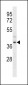 FPR3 Antibody (C-term)